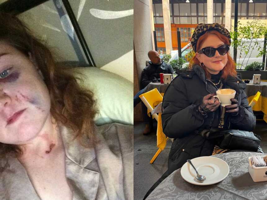 woman before and after becoming sober